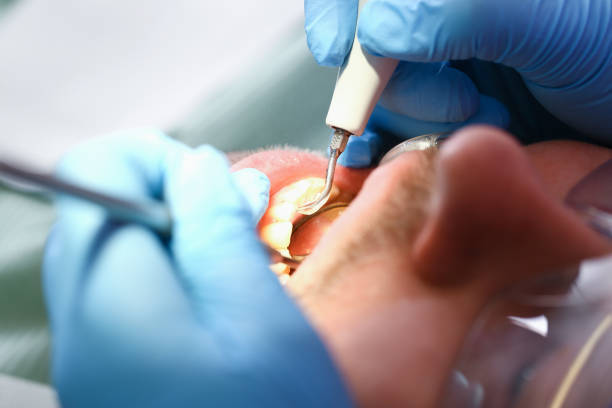 Best Emergency Broken Tooth Repair in Snow Hill, NC